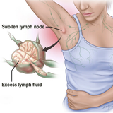 Lymph Care Herbal Detox Patch